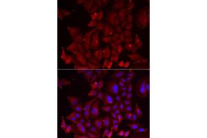 Immunofluorescence analysis of U2OS cell using PANX1 antibody.