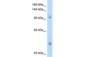 Western Blotting (WB) image for anti-Nuclear Factor of kappa Light Polypeptide Gene Enhancer in B-Cells 1 (NFKB1) antibody (ABIN2461714) (NFKB1 antibody)