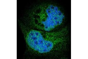 Immunofluorescent staining of A-431 cells with SYVN1 polyclonal antibody  (Green) shows positivity in endoplasmic reticulum and nucleus but excluded from the nucleoli.