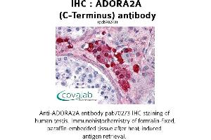Image no. 1 for anti-Adenosine A2a Receptor (ADORA2A) (C-Term), (Cytoplasmic Domain) antibody (ABIN1731565) (Adenosine A2a Receptor antibody  (C-Term, Cytoplasmic Domain))