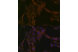 Immunofluorescence analysis of C6 cells using DDX6 Rabbit mAb (ABIN7266703) at dilution of 1:100 (40x lens). (DDX6 antibody)