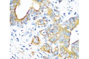 Immunohistochemistry of paraffin-embedded Human stomach using MTCO2 Polyclonal Antibody at dilution of 1:100 (40x lens). (COX2 antibody)