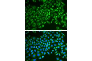 Immunofluorescence analysis of MCF-7 cells using SELE antibody (ABIN5971217). (Selectin E/CD62e antibody)