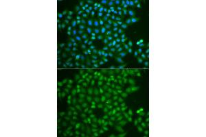 Immunofluorescence analysis of A549 cell using UCHL5 antibody. (UCHL5 antibody)