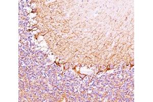 IHC testing of cerebellum stained with Neurofilament Heavy antibody (RT97). (NEFH antibody)