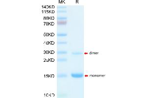 Mouse S100A9/MRP14 on Tris-Bis PAGE under reduced condition. (S100A9 Protein (AA 2-113) (His tag))