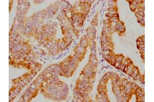 Immunohistochemistry (IHC) image for anti-Nuclear Factor of kappa Light Polypeptide Gene Enhancer in B-Cells Inhibitor, alpha (NFKBIA) antibody (ABIN7127641)