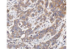 IHC analysis of Glycogen synthase 1/GYS1 using anti-Glycogen synthase 1/GYS1 antibody (ABIN7602155). (Glycogen Synthase 1 antibody  (AA 60-640))