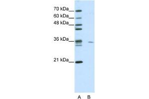 WB Suggested Anti-MDS032 Antibody Titration:  0. (Use1 antibody  (N-Term))