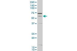 CYP1A2 polyclonal antibody (A01), Lot # 051122JC01 Western Blot analysis of CYP1A2 expression in A-431 . (CYP1A2 antibody  (AA 211-310))