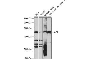 Western blot analysis of extracts of various cell lines, using AGL antibody (ABIN6131508, ABIN6136632, ABIN6136633 and ABIN6214165) at 1:1000 dilution. (AGL antibody  (AA 1233-1532))