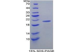 SDS-PAGE analysis of Mouse Diamine Oxidase Protein. (DAO Protein)