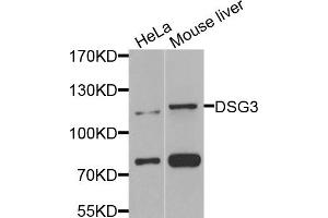 Western blot analysis of extracts of various cell lines, using DSG3 antibody (ABIN5974847) at 1/1000 dilution. (Desmoglein 3 antibody)