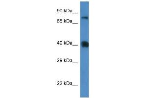 WB Suggested Anti-Slc7a3 Antibody   Titration: 1. (SLC7A3 antibody  (Middle Region))