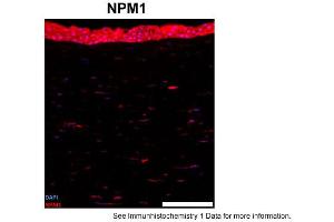 Immunohistochemistry (IHC) image for anti-Nucleophosmin (Nucleolar phosphoprotein B23, Numatrin) (NPM1) (C-Term) antibody (ABIN2778268)