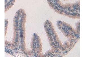 Detection of CARD9 in Mouse Oviduct Tissue using Polyclonal Antibody to Caspase Recruitment Domain Family, Member 9 (CARD9) (CARD9 antibody  (AA 274-530))