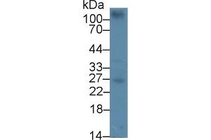 Detection of CEBPd in Mouse Spleen lysate using Polyclonal Antibody to CCAAT/Enhancer Binding Protein Delta (CEBPd) (CEBPD antibody  (AA 51-251))