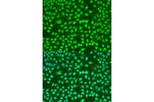 Immunofluorescence analysis of U2OS cells using PSEN2 antibody. (Presenilin 2 antibody)