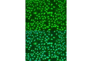 Immunofluorescence analysis of U2OS cells using PSEN2 antibody. (Presenilin 2 antibody)