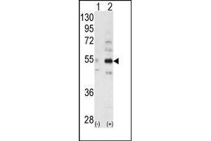 Western blot analysis of ALS2CR2 (arrow) using ALS2CR2 Antibody (STRADB antibody  (C-Term))