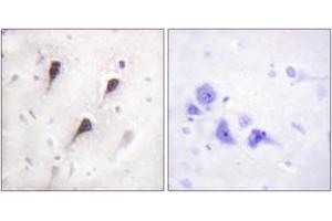 Immunohistochemistry analysis of paraffin-embedded human brain tissue, using WAVE1 (Ab-125) Antibody. (WASF1 antibody  (AA 91-140))