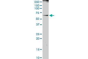 PRAME MaxPab polyclonal antibody. (PRAME antibody  (AA 1-509))