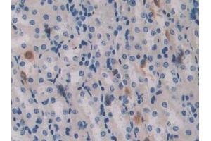 Used in DAB staining on fromalin fixed paraffin- embedded brain tissue (Aggrecan antibody  (AA 587-684))