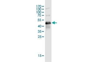 Western Blot detection against Immunogen (50 KDa) . (TMEM179B antibody  (AA 1-219))