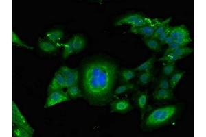 Immunofluorescent analysis of Hela cells using ABIN7152763 at dilution of 1:100 and Alexa Fluor 488-congugated AffiniPure Goat Anti-Rabbit IgG(H+L) (FGG antibody  (AA 278-437))