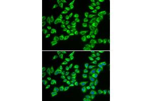 Immunofluorescence analysis of A549 cells using HADHB antibody (ABIN5973344). (HADHB antibody)