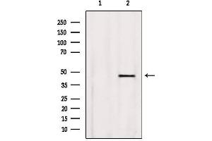 Western blot analysis of extracts from Rat heart, using BBS5 Antibody. (BBS5 antibody  (C-Term))