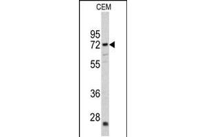 Western blot analysis of CRAT antibody in CEM cell line lysates (35ug/lane) (CRAT antibody  (N-Term))