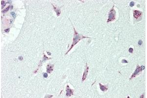 CASC4 Antikörper  (AA 336-365)