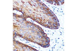 Immunohistochemistry of paraffin-embedded human esophageal using GM130 Rabbit mAb (ABIN7267494) at dilution of 1:100 (40x lens). (Golgin A2 (GOLGA2) antibody)