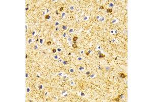 Immunohistochemistry of paraffin-embedded Rat brain using BIN1 antibody at dilution of 1:100 (x400 lens). (BIN1 antibody  (AA 230-409))