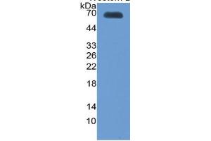 WB of Protein Standard: different control antibodies  against Highly purified E. (Thrombopoietin ELISA Kit)