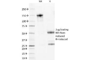 SDS-PAGE Analysis Purified Wilm's Tumor Mouse Monoclonal Antibody (6F-H2). (WT1 antibody  (AA 1-181))
