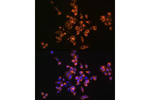 Immunofluorescence analysis of HeLa cells using [KO Validated] Annexin /Annexin V Rabbit pAb (ABIN3022450, ABIN3022451, ABIN3022452 and ABIN1512578) at dilution of 1:100 (40x lens). (Annexin V antibody  (AA 1-320))