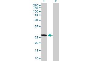 Western Blot analysis of ASB9 expression in transfected 293T cell line by ASB9 MaxPab polyclonal antibody. (ASB9 antibody  (AA 1-294))