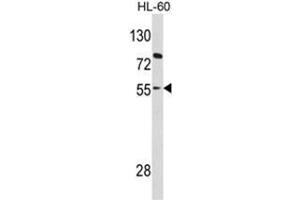 Western blot analysis of PAX8 Antibody (Center) in HL-60 cell line lysates (35ug/lane).