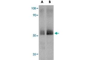 Western blot analysis of SPRED2 in human small intestine tissue lysate with SPRED2 polyclonal antibody  at (A) 1 and (B) 2 ug/mL . (SPRED2 antibody  (Internal Region))