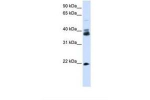 Image no. 1 for anti-Synaptophysin (SYP) (N-Term) antibody (ABIN6738166) (Synaptophysin antibody  (N-Term))