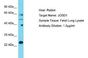 Host: Rabbit Target Name: JOSD1 Sample Tissue: Human Fetal Lung Antibody Dilution: 1ug/ml (JOSD1 antibody  (N-Term))
