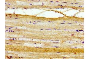 Immunohistochemistry of paraffin-embedded human skeletal muscle tissue using ABIN7142919 at dilution of 1:100 (AKIP1 antibody  (AA 57-167))