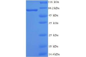 SH3-Domain GRB2-Like Endophilin B2 (SH3GLB2) (AA 1-395), (full length) protein (His-SUMO Tag)