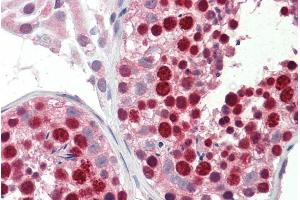 ABIN263230 (5µg/ml) staining of paraffin embedded Human Testis. (ABCA9 antibody  (Internal Region))