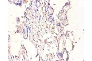 Immunohistochemistry of paraffin-embedded human placenta tissue using ABIN7145696 at dilution of 1:100 (BMP6 antibody  (AA 382-513))