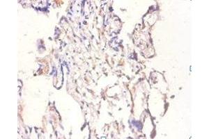 Immunohistochemistry of paraffin-embedded human placenta tissue using ABIN7145696 at dilution of 1:100