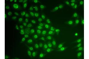 Immunofluorescence analysis of HeLa cells using CRY2 antibody (ABIN6130206, ABIN6139068, ABIN6139070 and ABIN6217229). (CRY2 antibody  (AA 455-614))