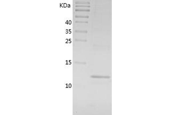 CCL7 Protein (AA 24-97) (His tag)